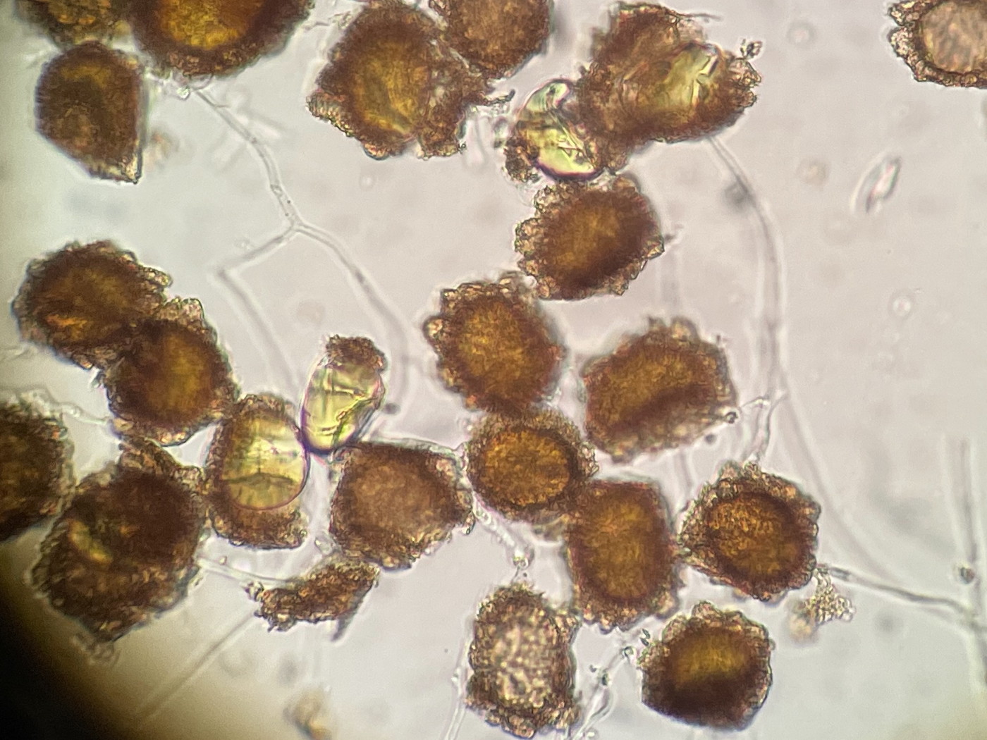 トヨグチイノデ、胞子側面。2022年9月10日 西沢渓谷 トヨグチイノデ、胞子側面。2022年9月10日 西沢渓谷