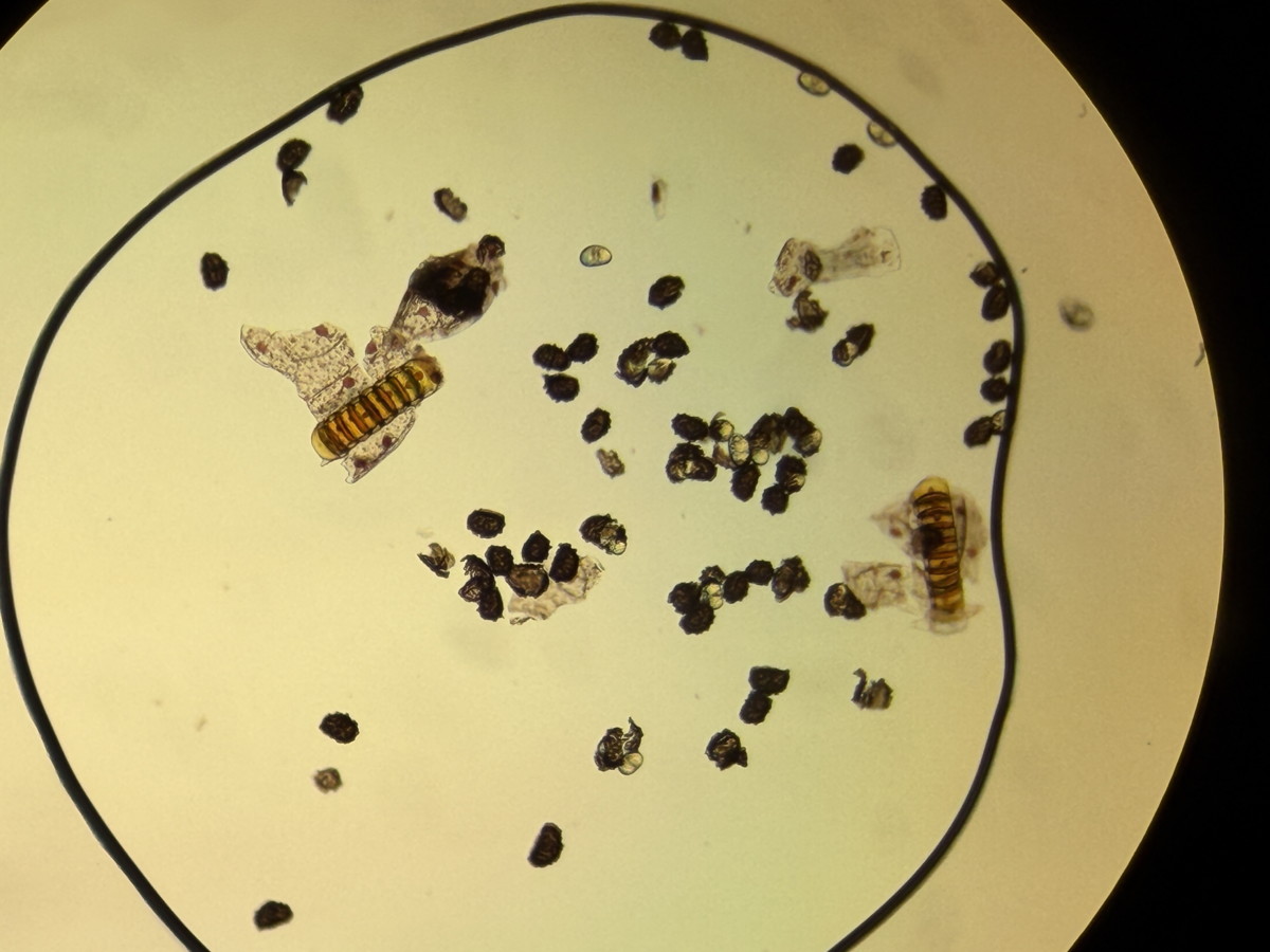 オクタマシダ、胞子数は53個程度確認、胞子の大きさ・形は整う。2025年10月25日 水窪 オクタマシダ、胞子数は53個程度確認、胞子の大きさ・形は整う。2025年10月25日 水窪
