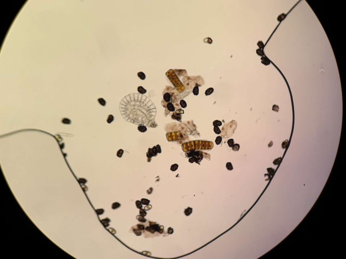 オクタマシダ、胞子数は56個程度確認、胞子の大きさ・形は整う。2025年10月25日 水窪 オクタマシダ、胞子数は56個程度確認、胞子の大きさ・形は整う。2025年10月25日 水窪