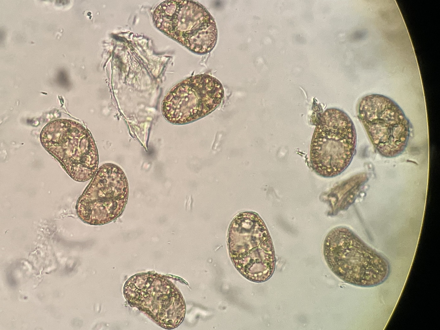 大形のヤマイヌワラビ(小羽軸有棘)、胞子数は55個程度確認、胞子側面。2022年7月22日 西沢渓谷 大形のヤマイヌワラビ(小羽軸有棘)、胞子数は55個程度確認、胞子側面。2022年7月22日 西沢渓谷