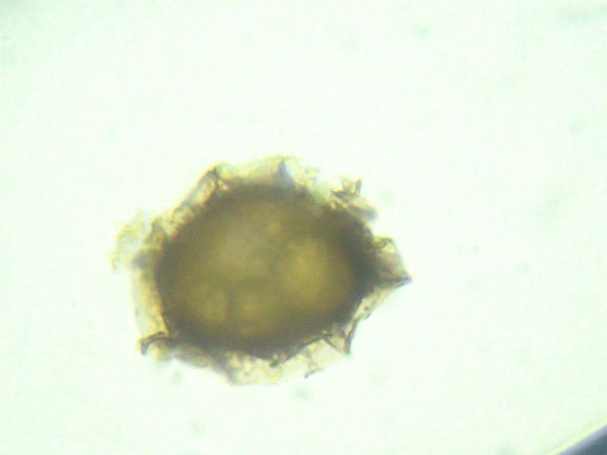 ヒメイワトラノオ、胞子側面。2017年7月2日 西沢渓谷 ヒメイワトラノオ、胞子側面。2017年7月2日 西沢渓谷