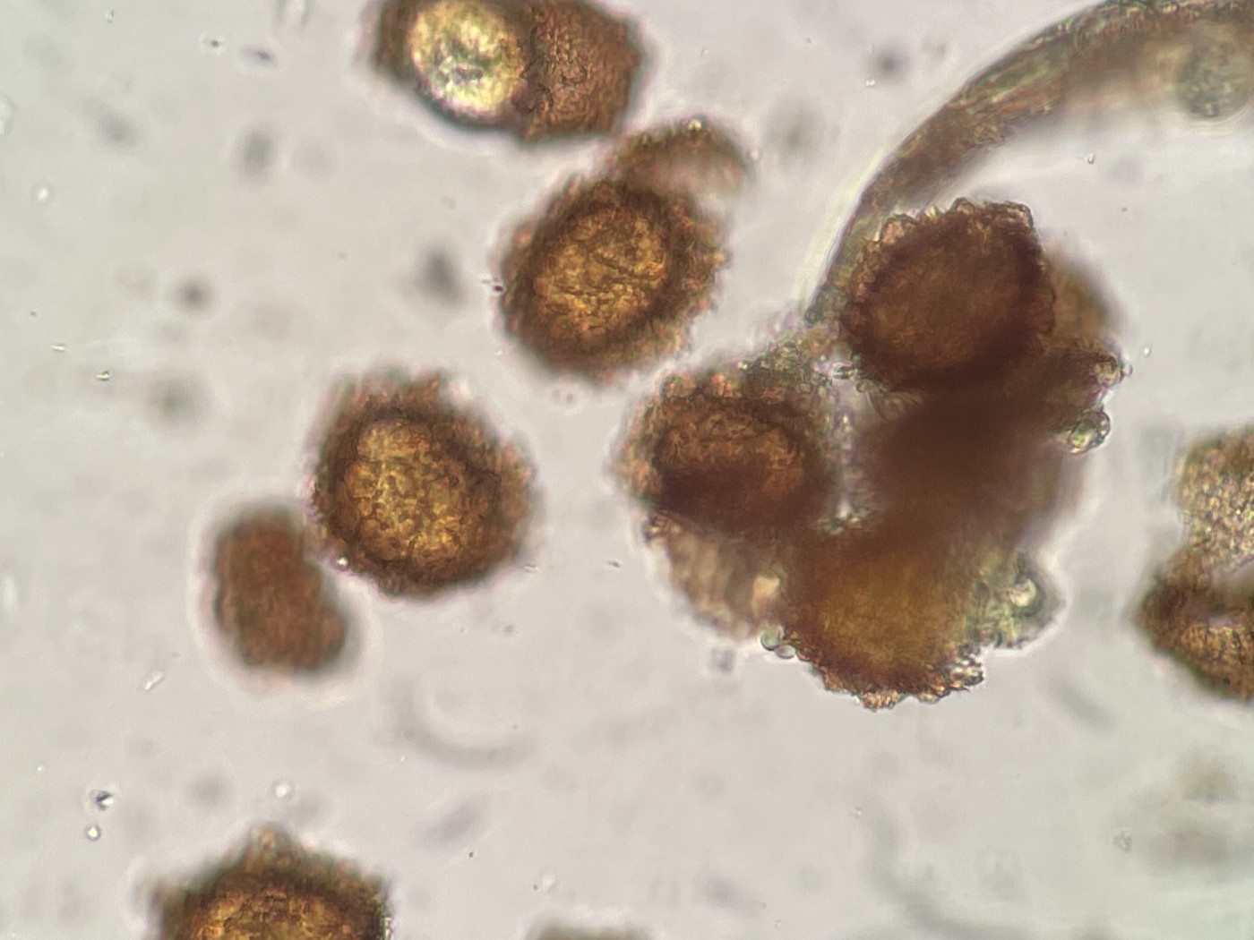 ホソイノデ、胞子上面。2022年9月10日 西沢渓谷 ホソイノデ、胞子上面。2022年9月10日 西沢渓谷