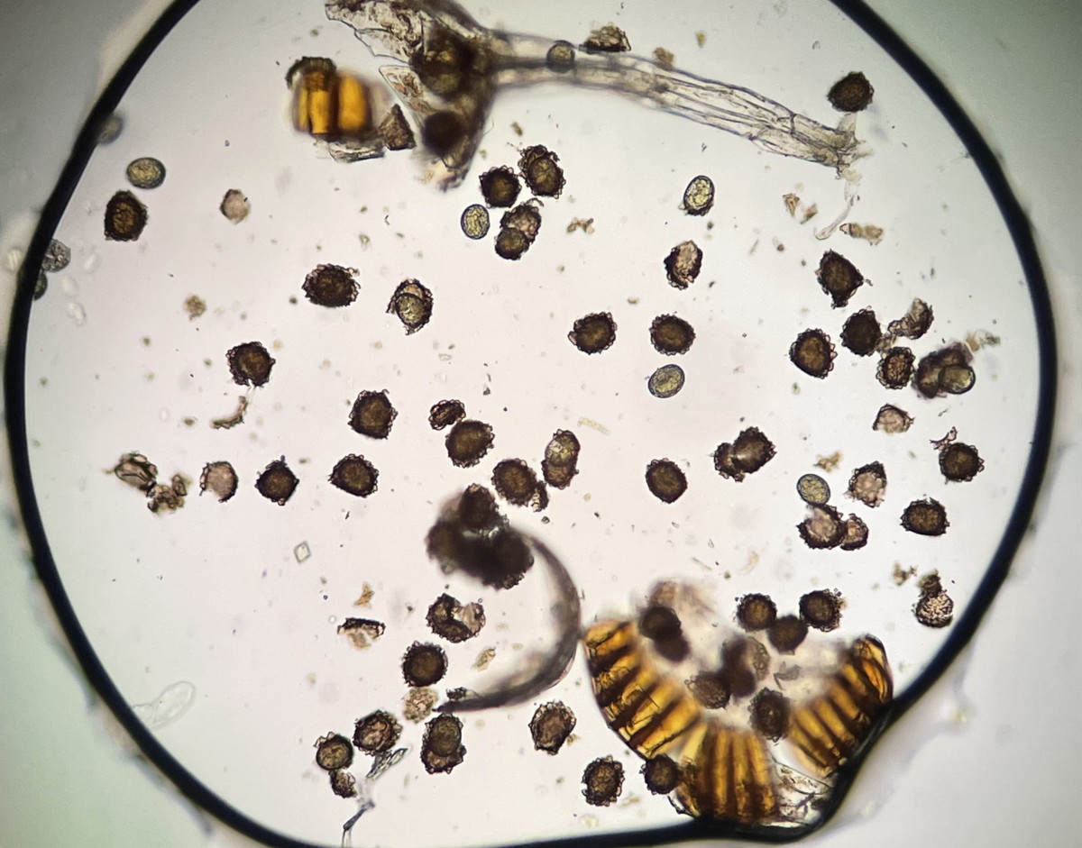 ホソイノデ、胞子数は60個以上確認。胞子の大きさ・形は整い有性生殖種と推定される。2022年9月10日 西沢渓谷 ホソイノデ、胞子数は60個以上確認。胞子の大きさ・形は整い有性生殖種と推定される。2022年9月10日 西沢渓谷