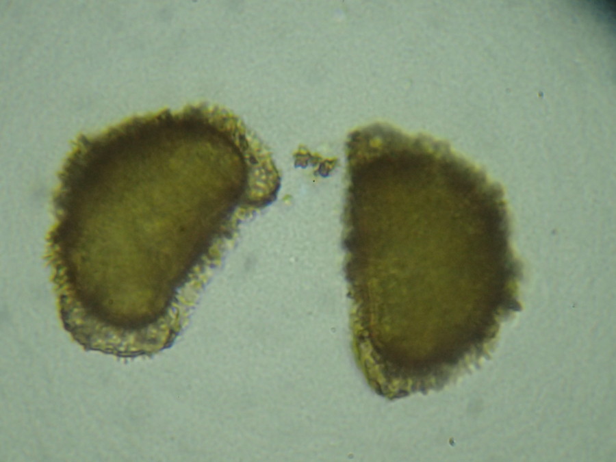 イワハリガネワラビ、胞子側面。2018年8月21日 山梨 西沢渓谷 イワハリガネワラビ、胞子側面。2018年8月21日 山梨 西沢渓谷
