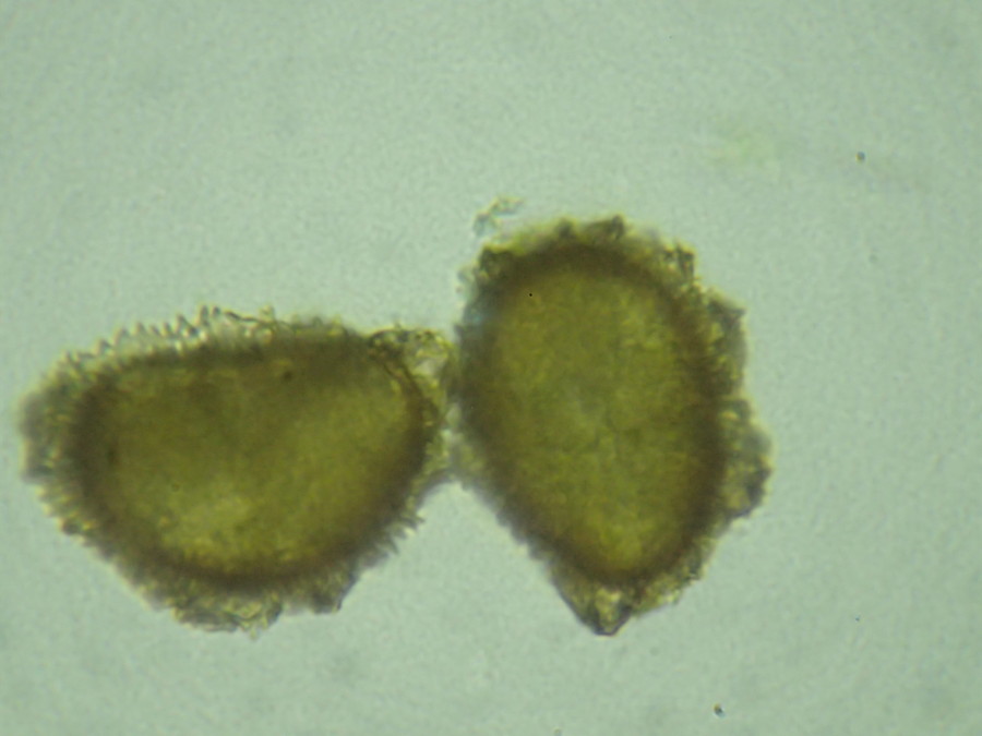 イワハリガネワラビ、胞子側面。2018年8月21日 山梨 西沢渓谷 イワハリガネワラビ、胞子側面。2018年8月21日 山梨 西沢渓谷