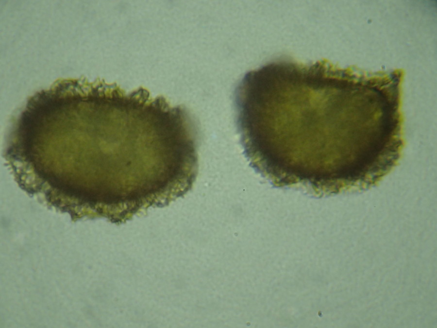 イワハリガネワラビ、胞子側面。2018年8月21日 山梨 西沢渓谷 イワハリガネワラビ、胞子側面。2018年8月21日 山梨 西沢渓谷