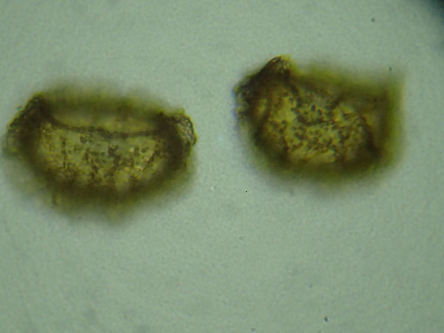 イワハリガネワラビ、胞子上面。2018年8月21日 山梨 西沢渓谷 イワハリガネワラビ、胞子上面。2018年8月21日 山梨 西沢渓谷