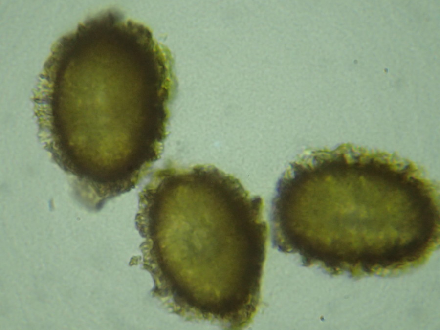 イワハリガネワラビ、胞子側面。2018年8月21日 山梨 西沢渓谷 イワハリガネワラビ、胞子側面。2018年8月21日 山梨 西沢渓谷