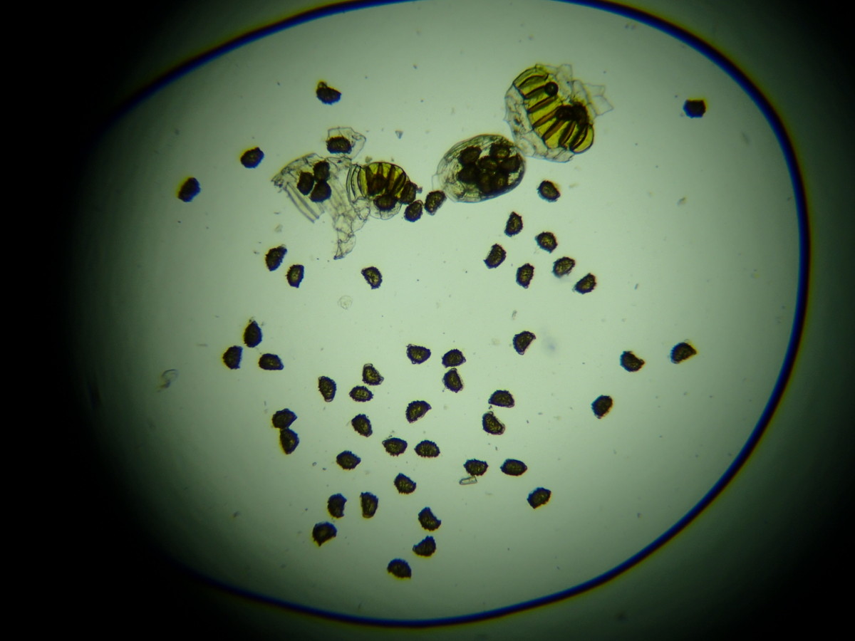 イワハリガネワラビ、胞子数は64個程度確認。大きさ形も整っている。2018年8月21日 山梨 西沢渓谷 イワハリガネワラビ、胞子数は64個程度確認。大きさ形も整っている。2018年8月21日 山梨 西沢渓谷