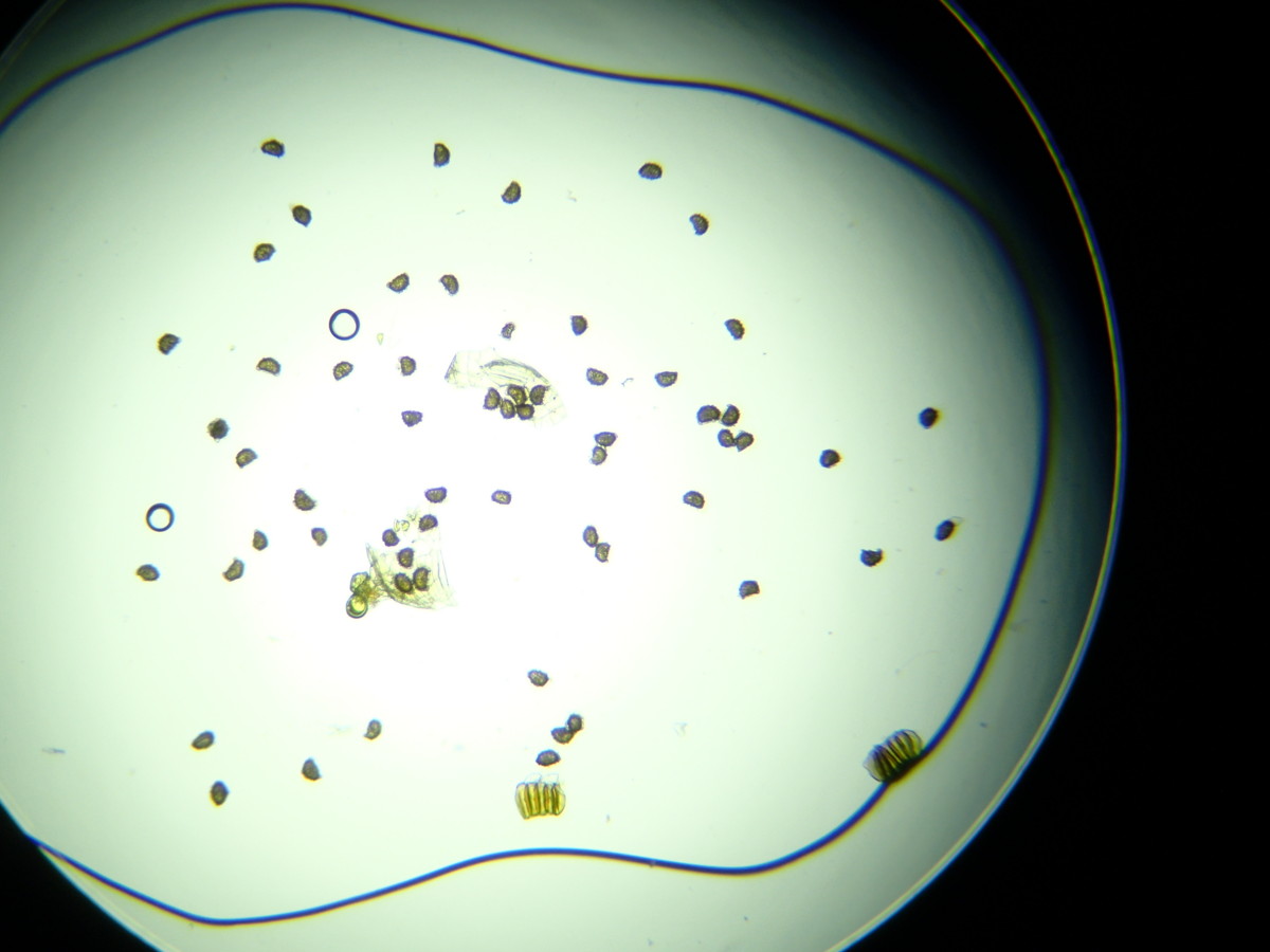 イワハリガネワラビ、胞子数は61個程度確認。大きさ形も整っている。2018年8月21日 山梨 西沢渓谷 イワハリガネワラビ、胞子数は61個程度確認。大きさ形も整っている。2018年8月21日 山梨 西沢渓谷