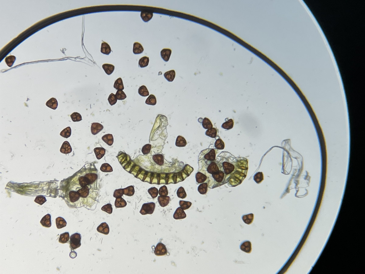 オオバノハチジョウシダ、胞子数は60個程度確認、大きさ形も整い有性生殖種。2021年6月26日 箱根 畑宿 オオバノハチジョウシダ、胞子数は60個程度確認、大きさ形も整い有性生殖種。2021年6月26日 箱根 畑宿