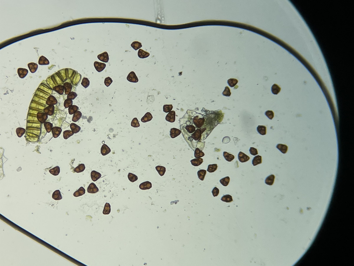 オオバノハチジョウシダ、胞子数は61個程度確認、大きさ形も整い有性生殖種。2021年6月26日 箱根 畑宿 オオバノハチジョウシダ、胞子数は61個程度確認、大きさ形も整い有性生殖種。2021年6月26日 箱根 畑宿