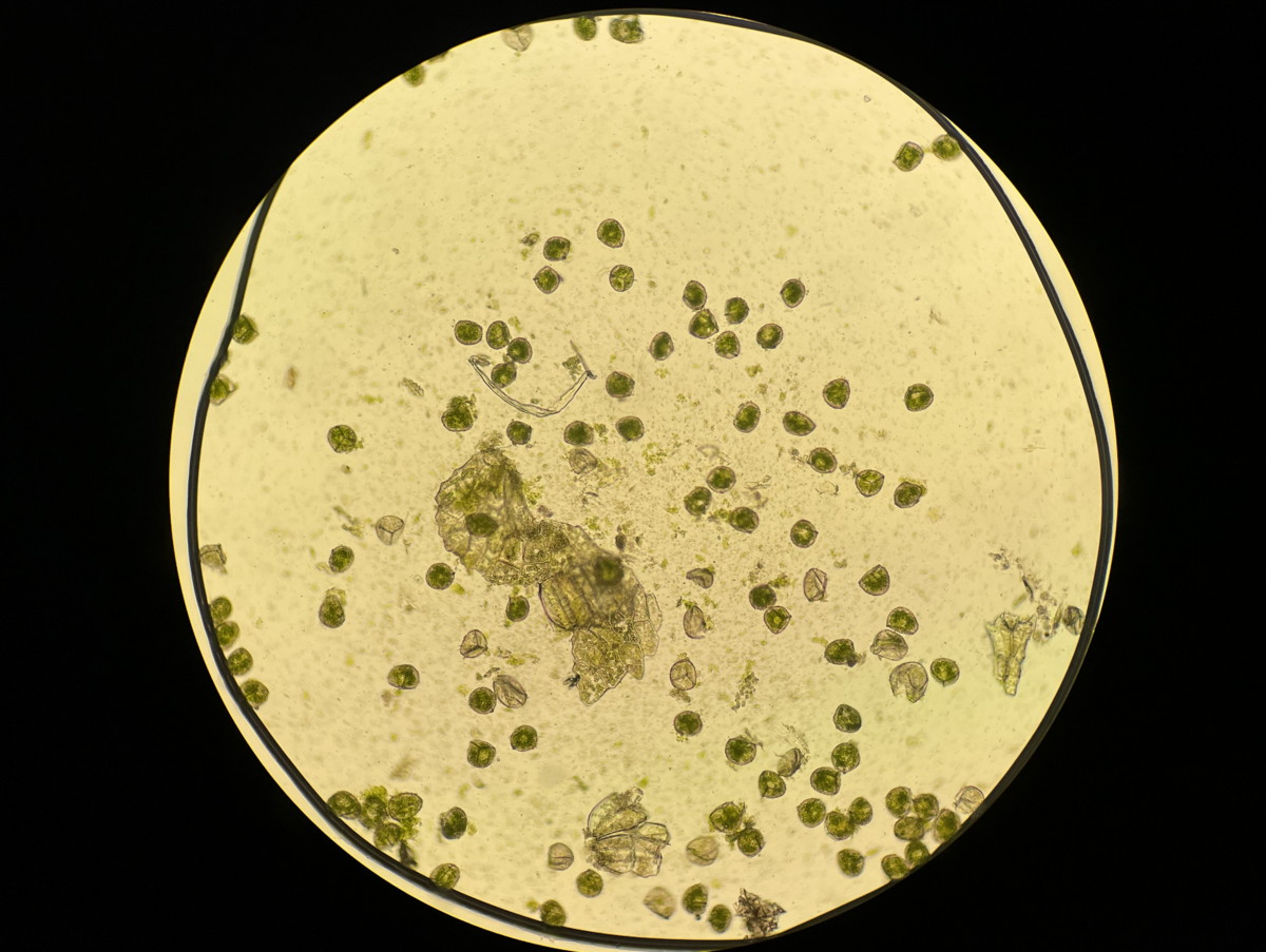 やや大形のヒメコケシノブ、胞子数は104個程度確認。胞子の大きさ・形は整い有性生殖種と考えられる。22年7月18日 西沢渓谷 やや大形のヒメコケシノブ、胞子数は104個程度確認。胞子の大きさ・形は整い有性生殖種と考えられる。22年7月18日 西沢渓谷