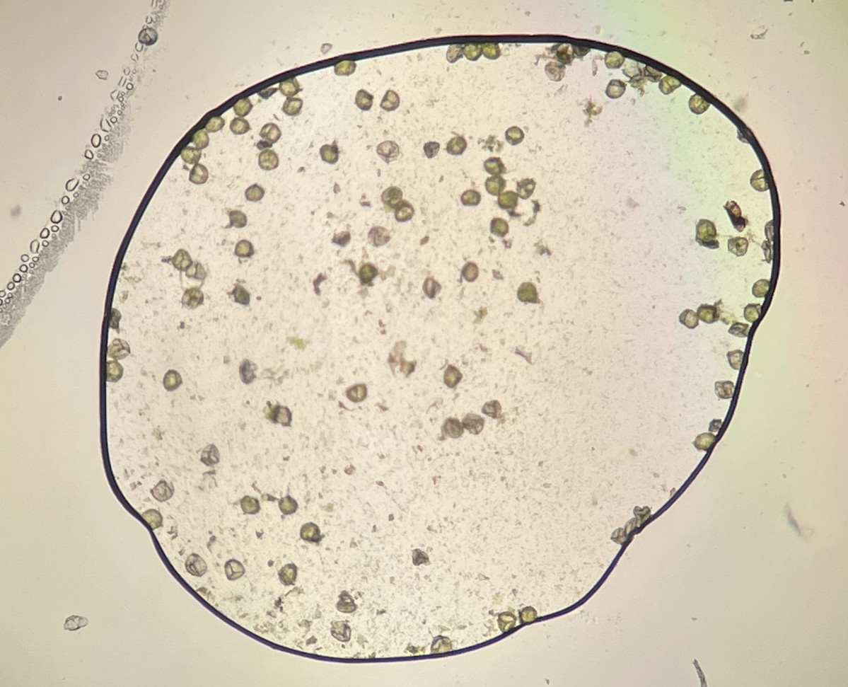 やや大形のヒメコケシノブ、胞子数は94個程度確認。胞子の大きさ・形は整い有性生殖種と考えられる。22年7月18日 西沢渓谷 やや大形のヒメコケシノブ、胞子数は94個程度確認。胞子の大きさ・形は整い有性生殖種と考えられる。22年7月18日 西沢渓谷