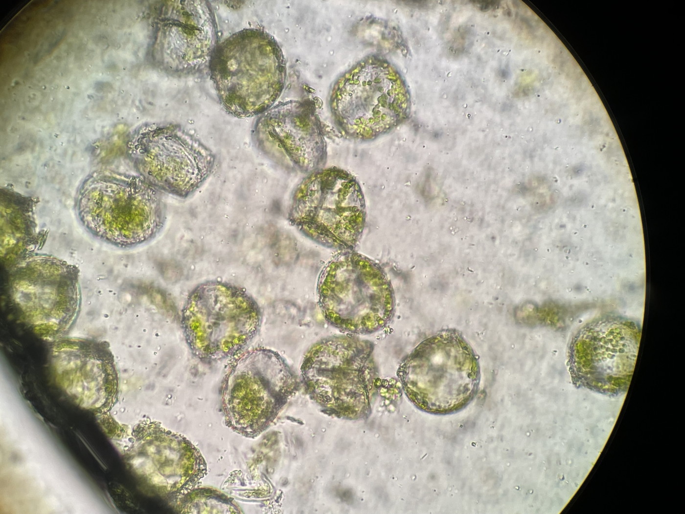 やや大形のヒメコケシノブ、胞子2。22年7月18日 西沢渓谷 やや大形のヒメコケシノブ、胞子2。22年7月18日 西沢渓谷