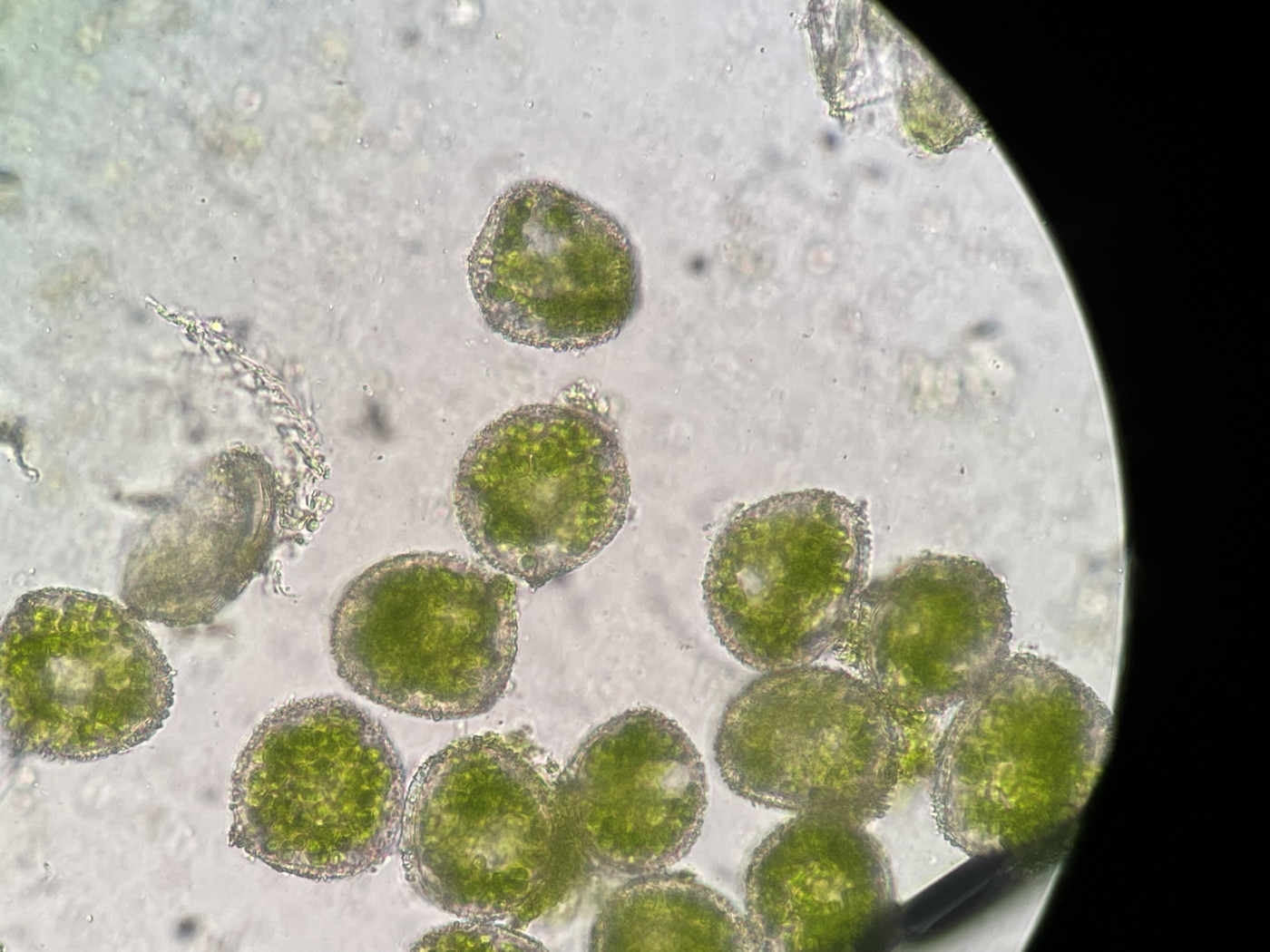 やや大形のヒメコケシノブ、胞子1側面のようす。22年7月18日 西沢渓谷 やや大形のヒメコケシノブ、胞子1側面のようす。22年7月18日 西沢渓谷