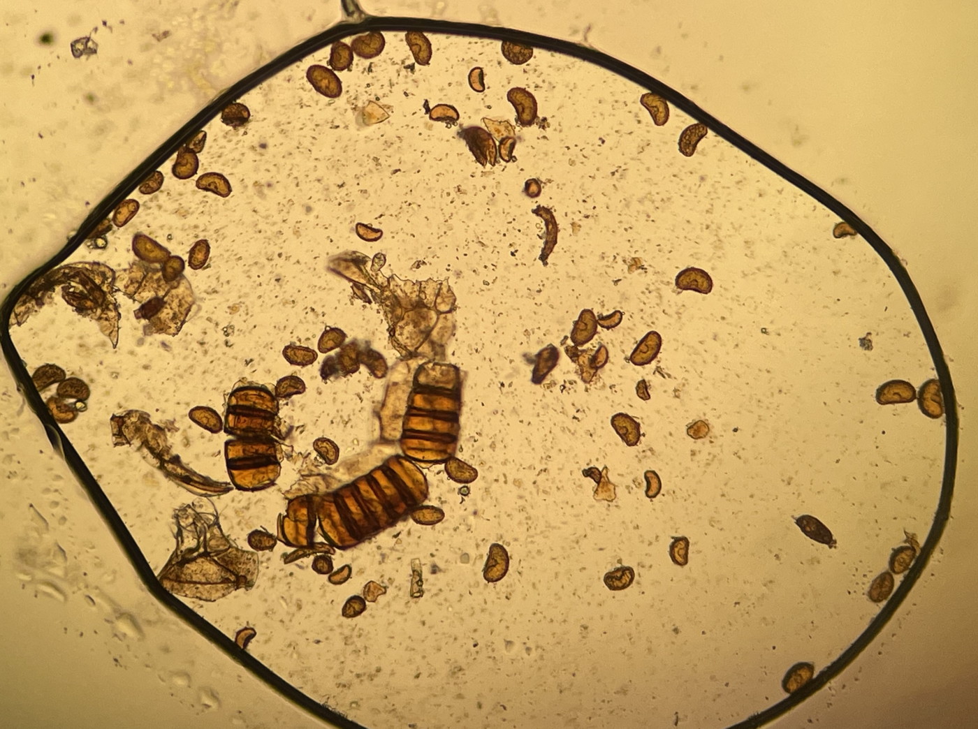 大形のヤマイヌワラビ(小羽軸有棘)、胞子数は61個程度確認、歪な胞子も相当数含まれていた。2023年9月9日 西沢渓谷 大形のヤマイヌワラビ(小羽軸有棘)、胞子数は61個程度確認、歪な胞子も相当数含まれていた。2023年9月9日 西沢渓谷