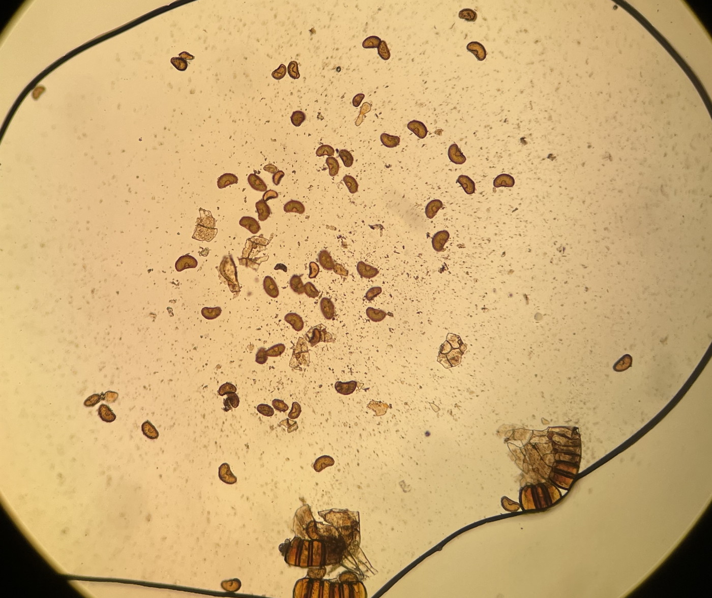 大形のヤマイヌワラビ(小羽軸有棘)、胞子数は61個程度確認、大きさ・形とも整う。2023年9月9日 西沢渓谷 大形のヤマイヌワラビ(小羽軸有棘)、胞子数は61個程度確認、大きさ・形とも整う。2023年9月9日 西沢渓谷