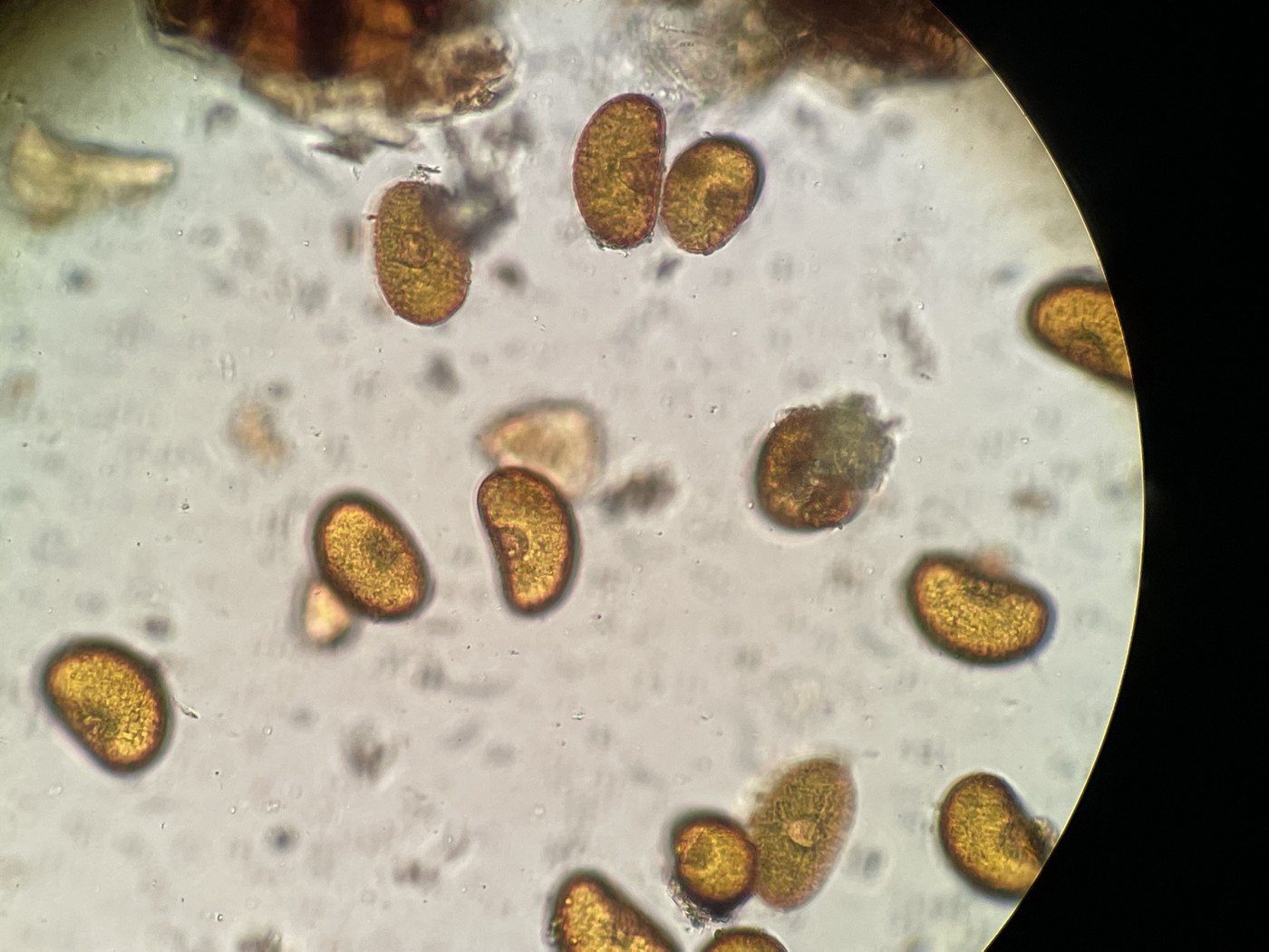 タカネサトメシダ<del>コシノサトメシダ</del>、胞子1上面。2022年7月22日 西沢渓谷 タカネサトメシダ<del>コシノサトメシダ</del>、胞子1上面。2022年7月22日 西沢渓谷