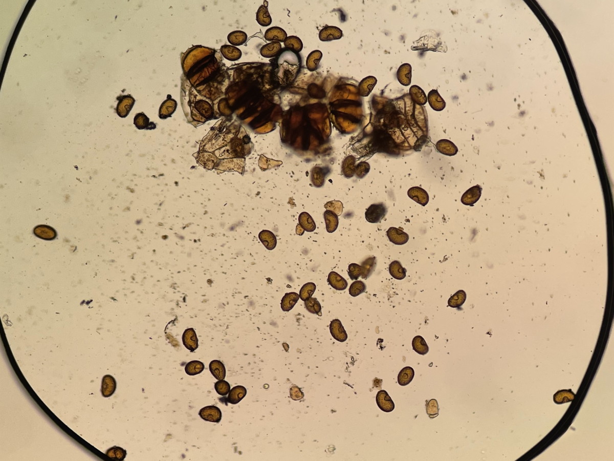 タカネサトメシダ<del>コシノサトメシダ</del>、胞子数は55個程度確認。胞子の大きさ・形は整い有性生殖種。2022年7月22日 西沢渓谷 タカネサトメシダ<del>コシノサトメシダ</del>、胞子数は55個程度確認。胞子の大きさ・形は整い有性生殖種。2022年7月22日 西沢渓谷