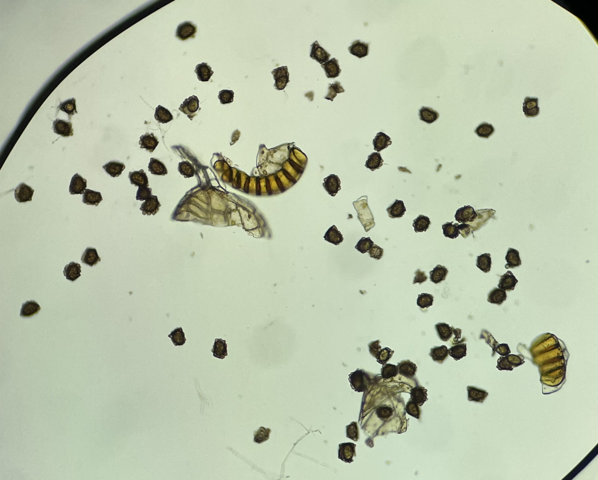 トヨグチイノデ、胞子数は60個以上確認。胞子の大きさ・形は整い有性生殖種と考えられる。2022年7月22日 山梨 西沢渓谷 トヨグチイノデ、胞子数は60個以上確認。胞子の大きさ・形は整い有性生殖種と考えられる。2022年7月22日 山梨 西沢渓谷