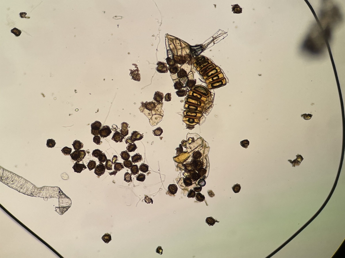 トヨグチイノデ、胞子数は60個以上確認。胞子の大きさ・形は整い有性生殖種と考えられる。2022年7月22日 山梨 西沢渓谷 トヨグチイノデ、胞子数は60個以上確認。胞子の大きさ・形は整い有性生殖種と考えられる。2022年7月22日 山梨 西沢渓谷