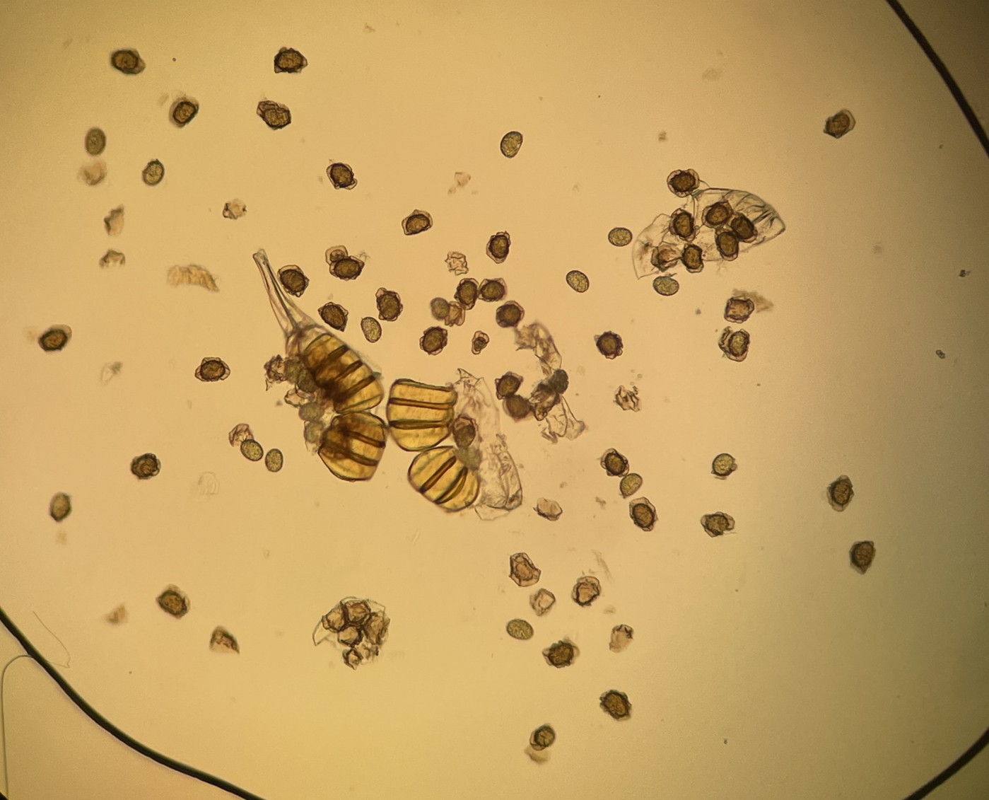 ツクシカナワラビ、胞子数は60個程度確認され、胞子の大きさ・形は整い有性生殖種と推定される。2025年8月26日 西伊豆町栽培株 ツクシカナワラビ、胞子数は60個程度確認され、胞子の大きさ・形は整い有性生殖種と推定される。2025年8月26日 西伊豆町栽培株