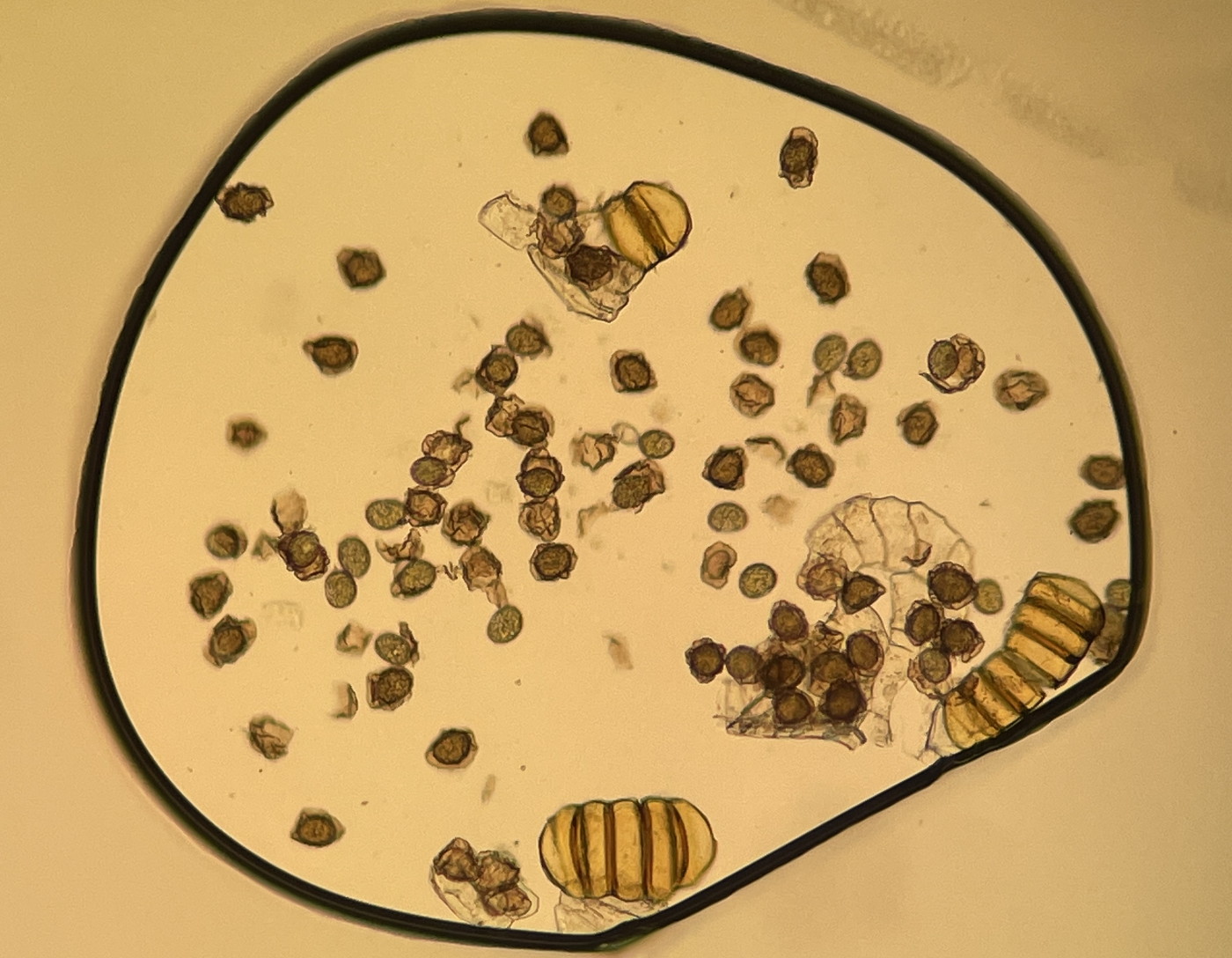 ツクシカナワラビ、胞子数は64個程度確認され、胞子の大きさ・形は整い有性生殖種と推定される。2025年8月26日 西伊豆町栽培株 ツクシカナワラビ、胞子数は64個程度確認され、胞子の大きさ・形は整い有性生殖種と推定される。2025年8月26日 西伊豆町栽培株