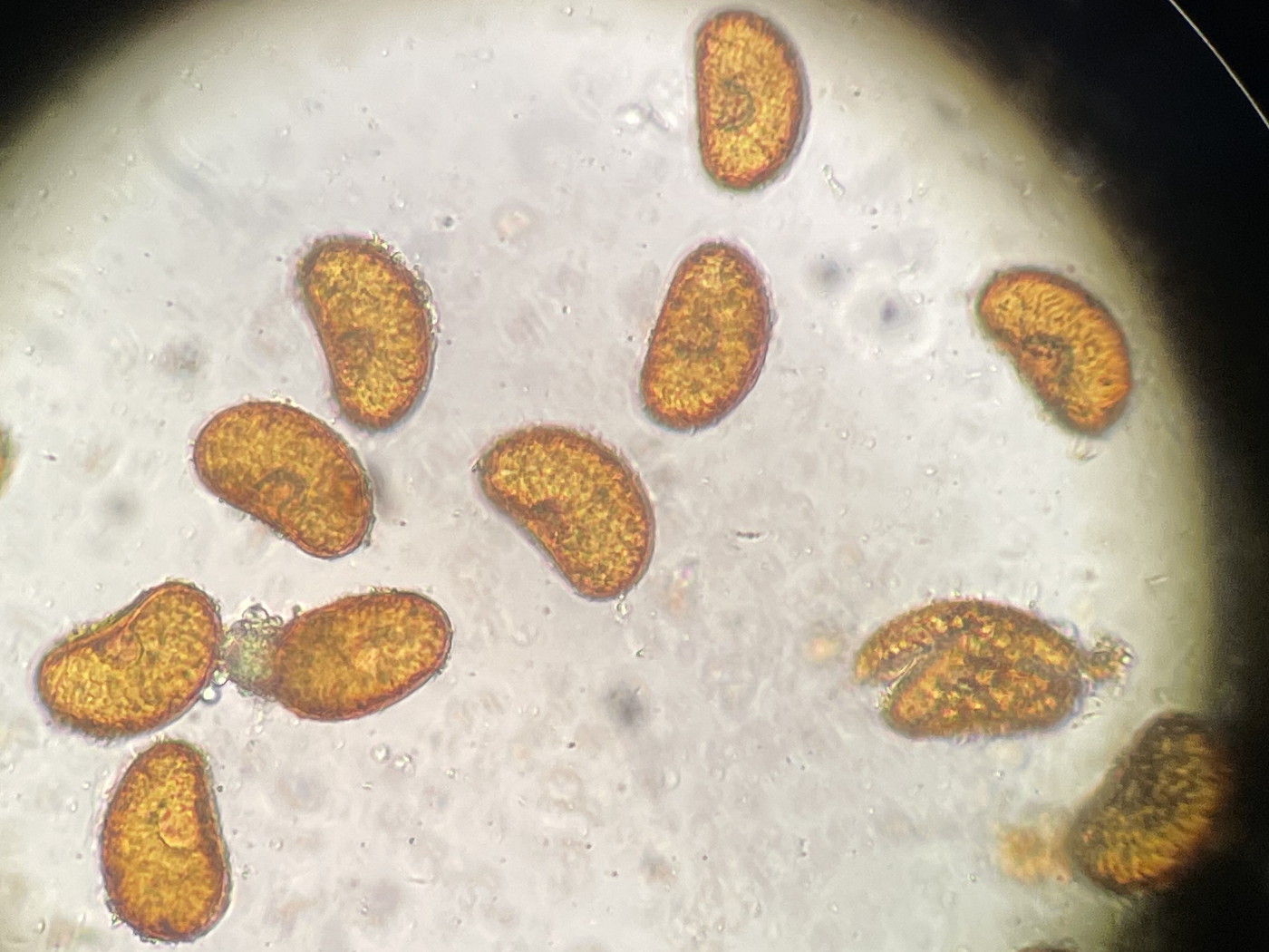 ヤマイヌワラビ、胞子側面。2022年7月22日 西沢渓谷 ヤマイヌワラビ、胞子側面。2022年7月22日 西沢渓谷
