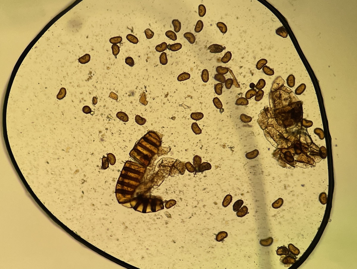 ヤマイヌワラビ、胞子数は60個以上確認。大きさ・形は整い有性生殖種と推定される。2022年7月22日 西沢渓谷 ヤマイヌワラビ、胞子数は60個以上確認。大きさ・形は整い有性生殖種と推定される。2022年7月22日 西沢渓谷