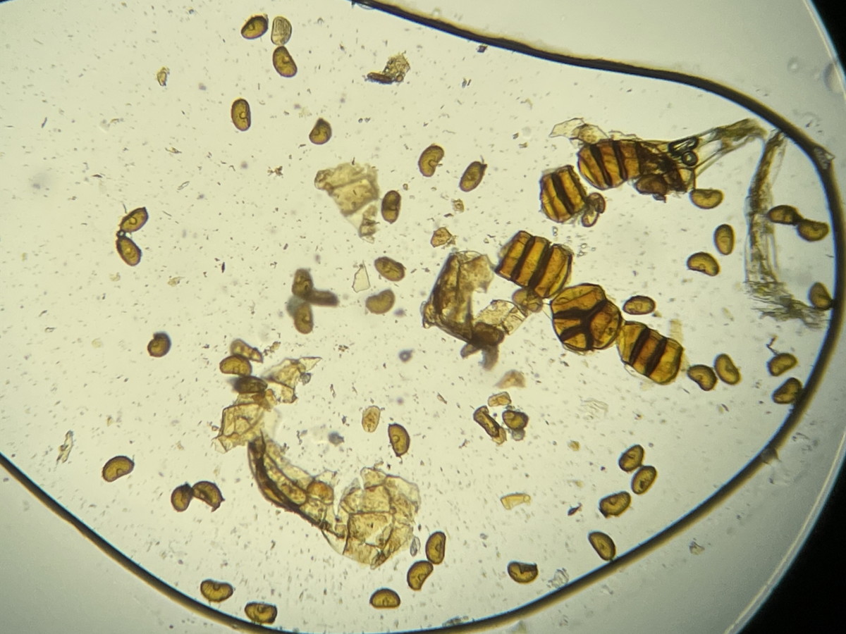 ヤマイヌワラビ、胞子数は54個程度確認、大きさ形が整い有性生殖種。2021年6月26日 箱根 畑宿 ヤマイヌワラビ、胞子数は54個程度確認、大きさ形が整い有性生殖種。2021年6月26日 箱根 畑宿