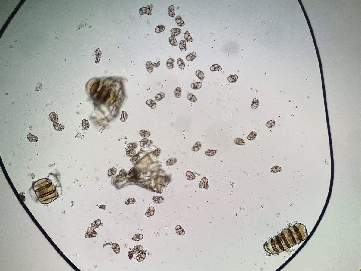 大形のヤマイヌワラビ(小羽軸有棘)、胞子数は60個程度確認、胞子の大きさ・形葉整っているが中身が透けて見え不充実。<del>雑種と思われる。</del>2022年7月22日 西沢渓谷 大形のヤマイヌワラビ(小羽軸有棘)、胞子数は60個程度確認、胞子の大きさ・形葉整っているが中身が透けて見え不充実。<del>雑種と思われる。</del>2022年7月22日 西沢渓谷