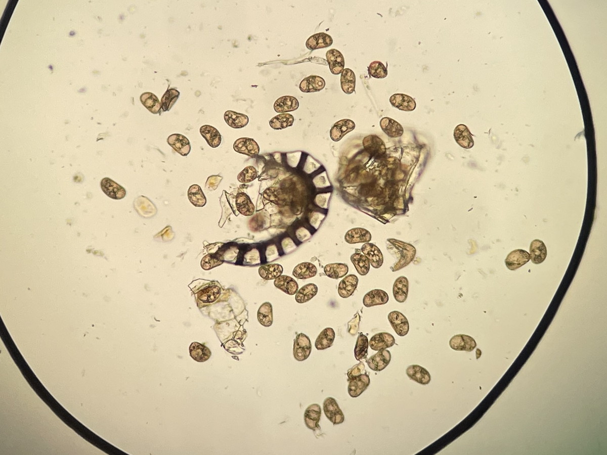 大形のヤマイヌワラビ(小羽軸有棘)、胞子数は55個程度確認、胞子の大きさ・形葉整っているが中身が透けて見え不充実。<del>雑種と思われる。</del>2022年7月22日 西沢渓谷 大形のヤマイヌワラビ(小羽軸有棘)、胞子数は55個程度確認、胞子の大きさ・形葉整っているが中身が透けて見え不充実。<del>雑種と思われる。</del>2022年7月22日 西沢渓谷