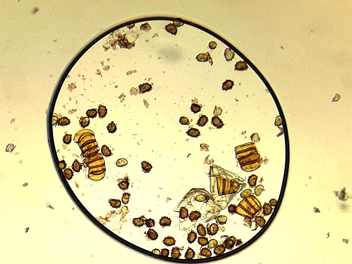 オオカナワラビ3、胞子数葉60個近く確認でき、胞子の大きさ・形は整い有性生殖種と推定。2025年11月13日 静岡 由比 オオカナワラビ3、胞子数葉60個近く確認でき、胞子の大きさ・形は整い有性生殖種と推定。2025年11月13日 静岡 由比