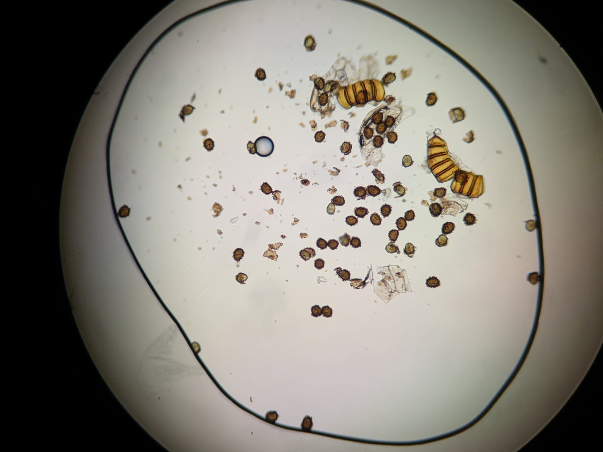 オオカナワラビ1、胞子数は57個程度確認。胞子の大きさ・形は整い有性生殖種と推定。2025年11月13日 静岡 由比 オオカナワラビ1、胞子数は57個程度確認。胞子の大きさ・形は整い有性生殖種と推定。2025年11月13日 静岡 由比