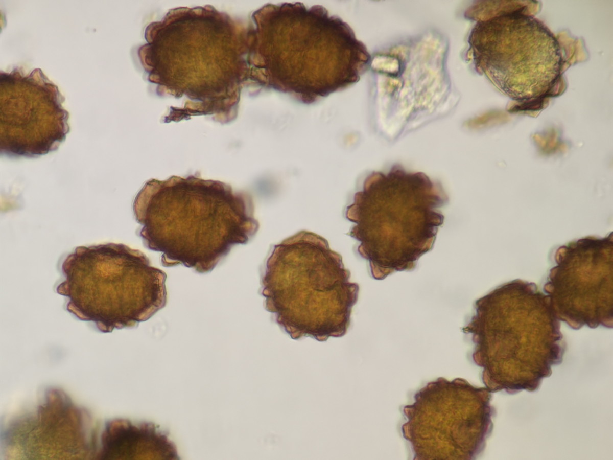 オオカナワラビ1、胞子側面。2025年11月13日 静岡 由比 オオカナワラビ1、胞子側面。2025年11月13日 静岡 由比