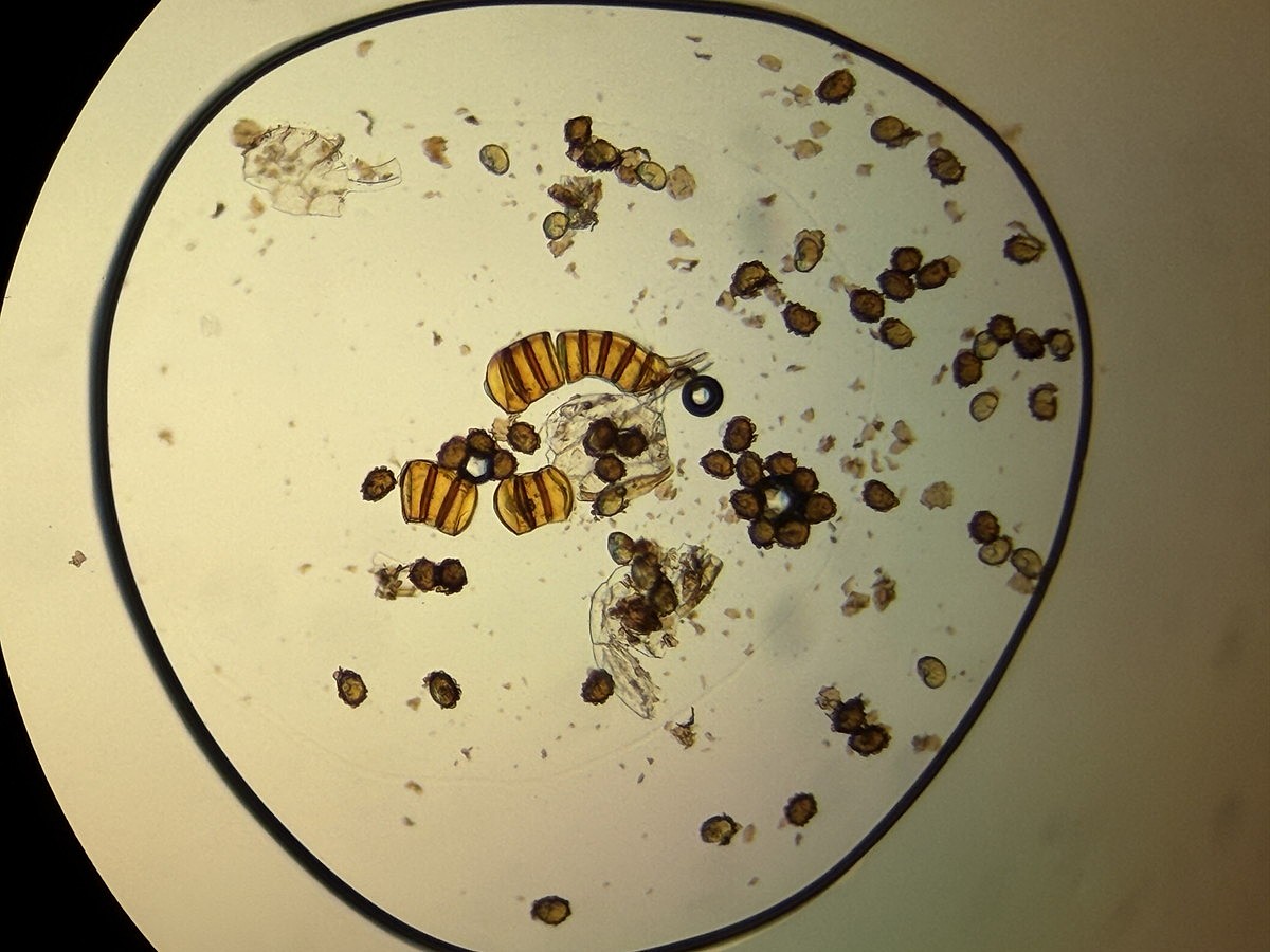 オオカナワラビ2、胞子数は62個程度確認。胞子の大きさ・形は整い有性生殖種と推定。2025年11月13日 静岡 由比 オオカナワラビ2、胞子数は62個程度確認。胞子の大きさ・形は整い有性生殖種と推定。2025年11月13日 静岡 由比